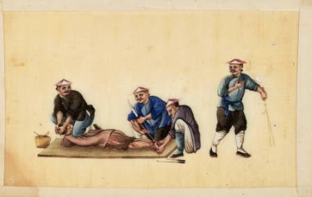 Versions of Punishment Prisoner having heel cut