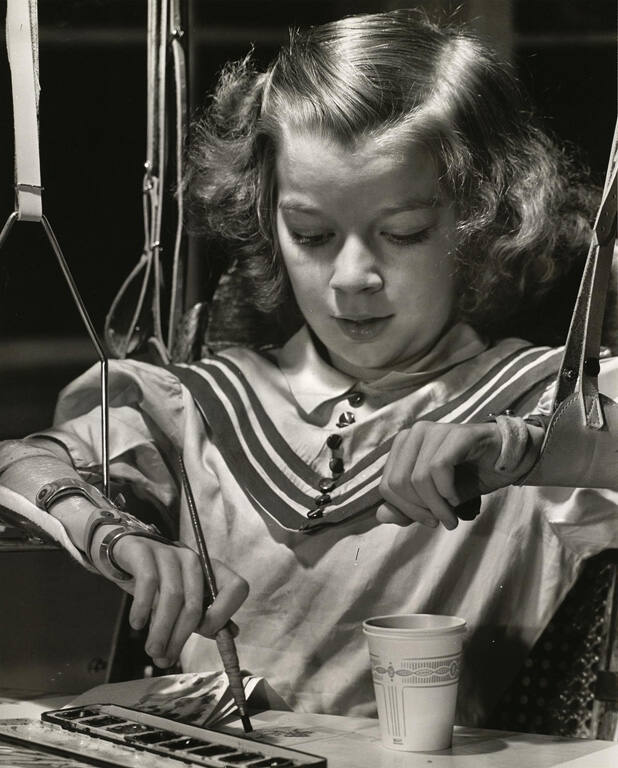 [Girl with polio, painting]