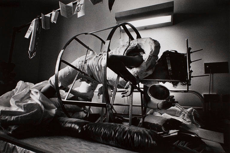 Hospital for Special Surgery: Boy in body cast